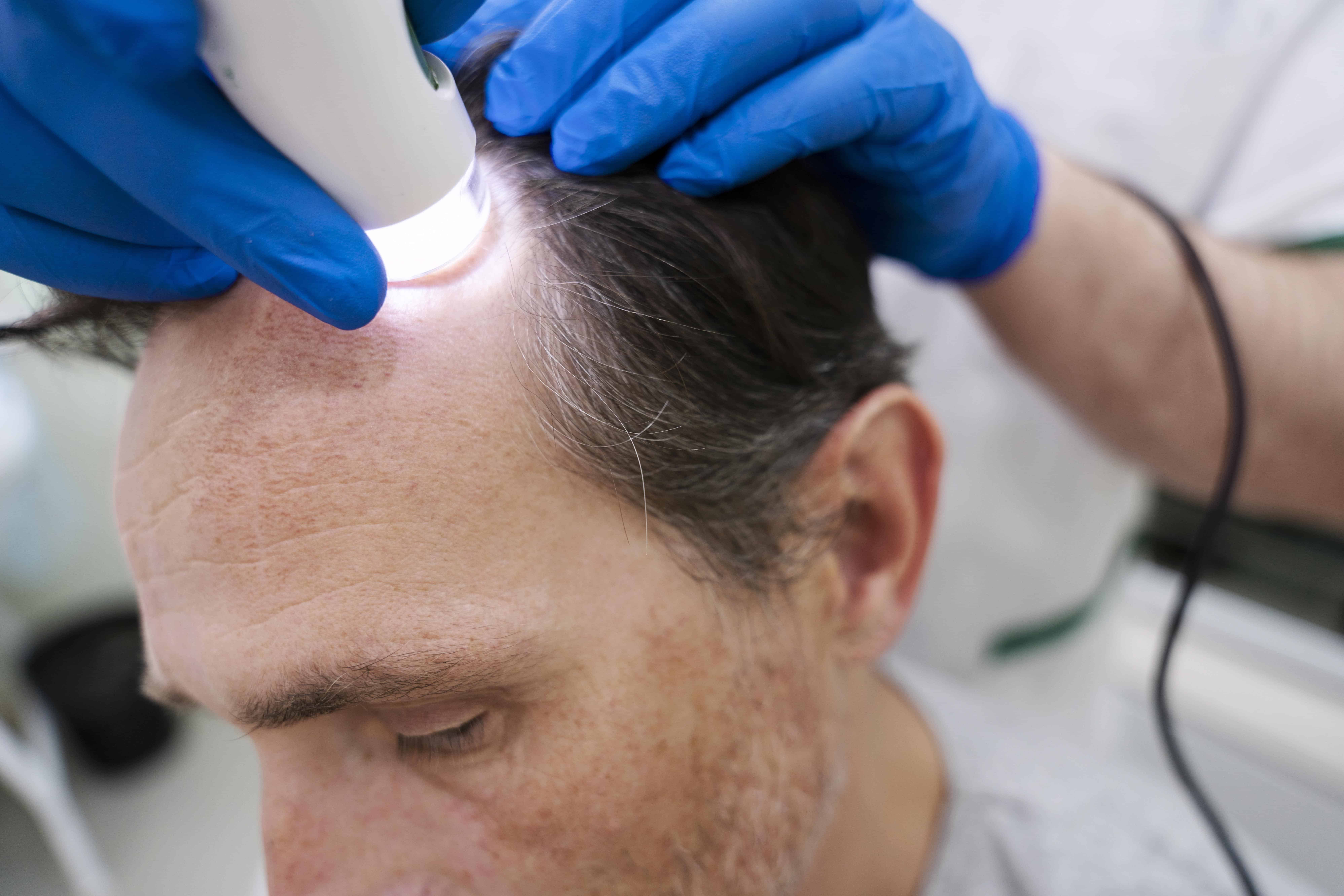 UK TVET Learning College | Hair Loss Treatment